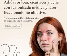 305414732-0-jc0APztoHo1776414109473.jpeg