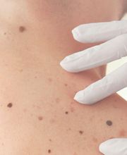 Schweiger Dermatology & Allergy - Millburn image 15