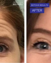 dermani MEDSPA Granger image 18