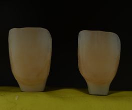 ModeLab Dental Bild 11