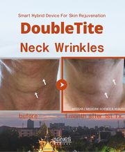 MEDILASE Lasers Médicaux et Photonique Médicale image 17