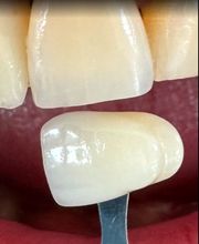 Vital Dental Lab image 1