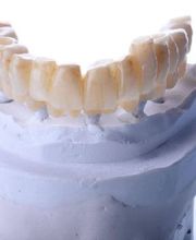 centre-odontologia-miret-puig-maqueta-dental-03.jpg