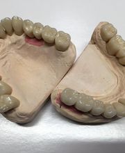 Dentaltechnik Oriwal Bild 4