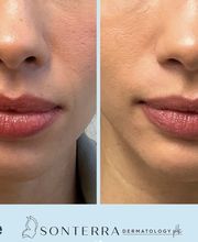 Sonterra Dermatology image 20