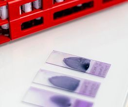 ANYDIAG image 2