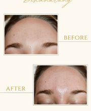 Skintastic Julia Riemer Bild 11