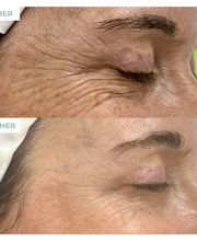 Bellaroba Lilly Bild 3