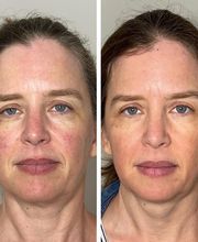 Wrinkle Free WA image 14