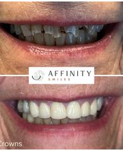 Affinity Smiles image 20