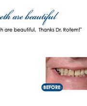 Rotem Dental Care image 19