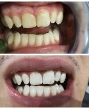 Dentalp SA Bild 2