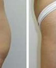 IMSEI Clinic imagen 4