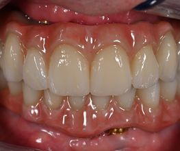 ModeLab Dental Bild 10
