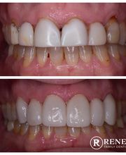 Renew Family Dentistry image 7