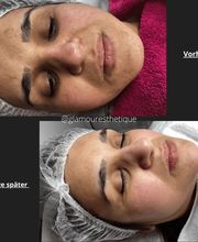 Glamour Esthétique Bild 12