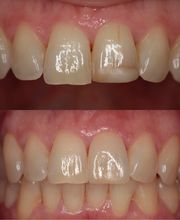 Zahnarztpraxis Dr. med. dent. Müller Wolfgang Bild 5