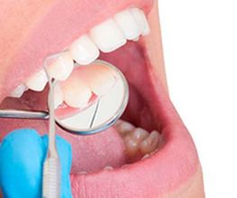 periodoncia.jpg