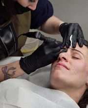 Micropigmentación para tí imagen 4