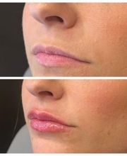 Truly Lifted MedSpa image 12