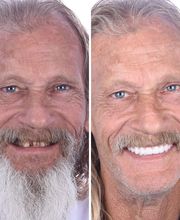 Britely Dentures + Implants Studio image 4