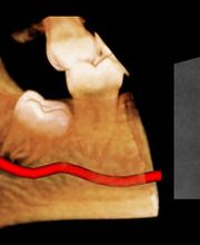 Clínica de Estética dental Láser .Algeciras.Dr Joaquín garcia rodriguez imagen 2