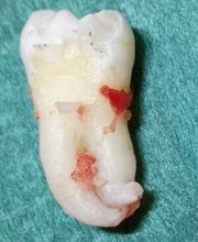 Zahnarzt Dr. med. dent. Franck R. Tolen Bild 9