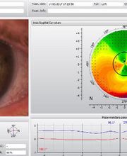 Muller Janz Opticiens Bild 13