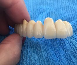 Dentaltechnik Oriwal Bild 5