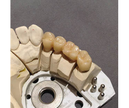 Dentallabor Kammin Bild 2