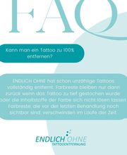 ENDLICH OHNE Tattooentfernung Filiale Dresden/Pirna Bild 14