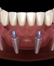 CLINICA DENTAL CEID imagen 9