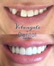 Vitangeli Dental image 4