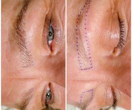 Augenbrauen Microblading - Skink Studio - Studio für Permanent Make-up in Köln
