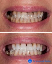 Providence Dental Spa | East Cobb image 11