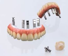 Dentallabor Christian Stroehl Bild 2