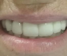 Clínica Dental Quart imagen 13