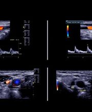 Gallery Professionale