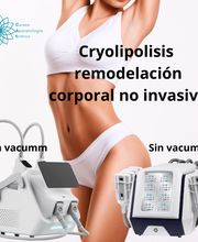 Cursos Online de Aparatología Estética (CAE) imagen 5
