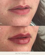 Skintonomy Medical Spa image 17