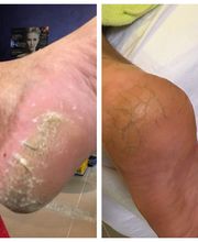 Ipanema Waxing, Beauty & Bademode Bild 12