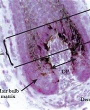 Electrolysis Center Laser Hair Removal image 13
