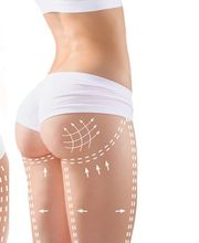 Praxis Med. Ästhetik Monica Hermann | Villingen-Schwenningen Bild 4