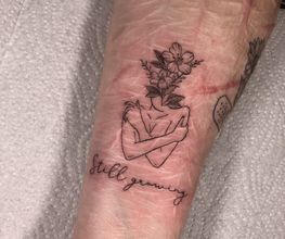 Narben Cover up.jpeg