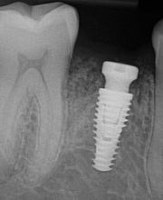 Gildner Family Dentistry of Lexington image 4