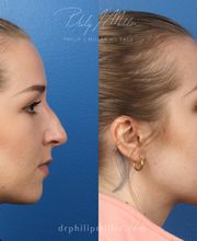 Gotham Plastic Surgery image 6