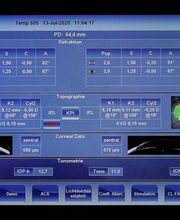 Optik Scheffer Essen