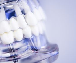Il Dentista Dr. Alessandro Rossi SA Bild 9