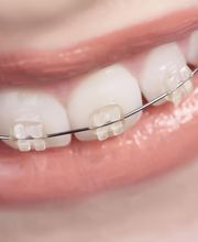 Isabel Perales Clínica Dental imagen 6
