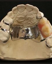 Hasenböhler Zahntechnik AG Bild 3